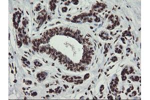 Immunohistochemical staining of paraffin-embedded Human breast tissue using anti-CHN1 mouse monoclonal antibody. (CHN1 anticorps)