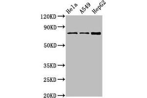 Western Blot Positive WB detected in: Hela whole cell lysate, A549 whole cell lysate, HepG2 whole cell lysate All lanes: TGM2 antibody at 4 μg/mL Secondary Goat polyclonal to rabbit IgG at 1/50000 dilution Predicted band size: 78, 62, 39 kDa Observed band size: 78 kDa (Transglutaminase 2 anticorps  (AA 4-544))