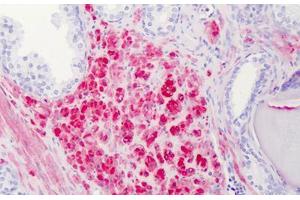 Human Prostate: Formalin-Fixed, Paraffin-Embedded (FFPE) (Calponin anticorps  (AA 1-298))