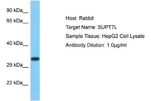 Host: Rabbit Target Name: SUPT7L Sample Type: HepG2 Whole Cell lysates Antibody Dilution: 1. (SUPT7L anticorps  (C-Term))