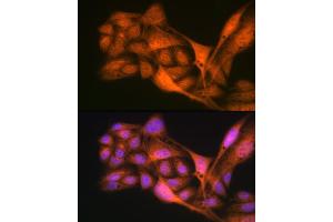 Immunofluorescence analysis of U-2 OS cells using Gli3 Rabbit mAb (ABIN7267385) at dilution of 1:100 (40x lens). (GLI3 anticorps)
