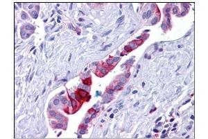 Human Pancreas, Duct: Formalin-Fixed, Paraffin-Embedded (FFPE)