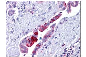 Human Pancreas, Duct: Formalin-Fixed, Paraffin-Embedded (FFPE) (Retinoblastoma Binding Protein 8 anticorps)