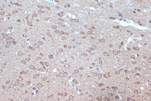 Immunohistochemistry of paraffin-embedded rat brain using B Rabbit mAb (ABIN7265849) at dilution of 1:100 (40x lens).