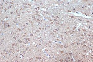 Immunohistochemistry of paraffin-embedded rat brain using B Rabbit mAb (ABIN7265849) at dilution of 1:100 (40x lens). (BAG2 anticorps)