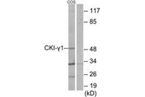 Western blot analysis of extracts from COS7 cells, using CKI-gamma1 Antibody. (CSNK1G1 anticorps  (AA 1-50))