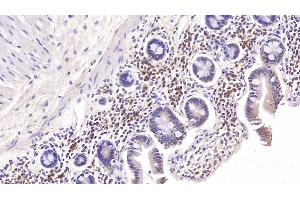 Detection of IL6 in Rabbit Colon Tissue using Monoclonal Antibody to Interleukin 6 (IL6)