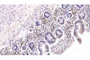 Detection of IL6 in Rabbit Colon Tissue using Monoclonal Antibody to Interleukin 6 (IL6) (IL-6 anticorps  (AA 27-241))