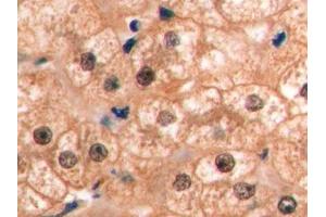 Detection of VEGF165 in Human Liver Tissue using Monoclonal Antibody to Vascular Endothelial Growth Factor 165 (VEGF165) (VEGF 165 (AA 28-191) anticorps)