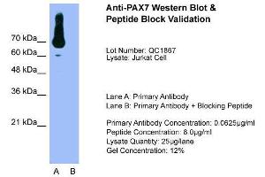 Host:  Rabbit  Target Name:  PAX7  Sample Type:  Jurkat  Lane A:  Primary Antibody  Lane B:  Primary Antibody + Blocking Peptide  Primary Antibody Concentration:  0.