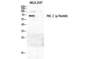 Western Blotting (WB) image for anti-Protein Kinase C, zeta (PRKCZ) (pThr560) antibody (ABIN3182129) (PKC zeta anticorps  (pThr560))