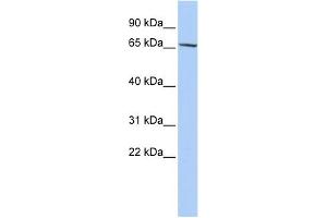 WB Suggested Anti-ZNF530 Antibody Titration:  0. (ZNF530 anticorps  (N-Term))