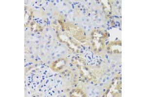 Immunohistochemistry of paraffin-embedded rat kidney using CTSC antibody.