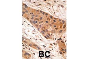 Immunohistochemistry (IHC) image for anti-BCL2/adenovirus E1B 19kDa Interacting Protein 1 (BNIP1) (BH3 Domain) antibody (ABIN2997180)