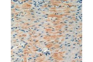 Used in DAB staining on fromalin fixed paraffin- embedded stomach tissue (IGFBP6 anticorps  (AA 46-238))