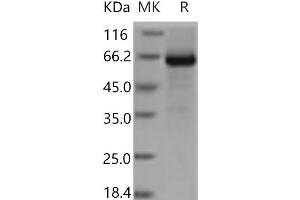 Western Blotting (WB) image for Glycoprotein Ib (Platelet), beta Polypeptide (GP1BB) protein (Fc Tag) (ABIN7321086)