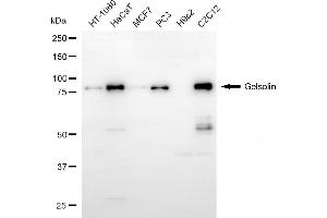 Western blotting analysis using gelsolin antibody (ABIN7798702).