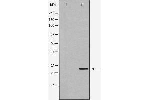 Western blot analysis of Hela whole cell lysates, using GSTP1 Antibody. (GSTP1 anticorps  (N-Term))