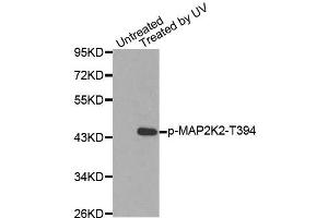 Western blot analysis of extracts from HepG2 cells using Phospho-MAP2K2-T394 antibody (ABIN2987359). (MEK2 anticorps  (pThr394))