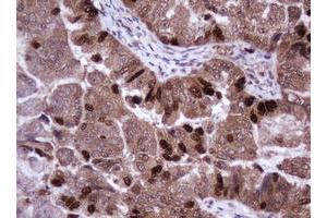 Image no. 2 for anti-Antigen Identified By Monoclonal Antibody Ki-67 (MKI67) (AA 2924-3256) antibody (ABIN1491345)