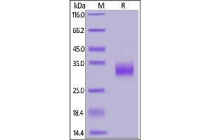Biotinylated Human TNFSF11, His,Avitag, active trimer(MALS verified) on  under reducing (R) condition. (RANKL Protein (AA 64-245) (His tag,AVI tag,Biotin))