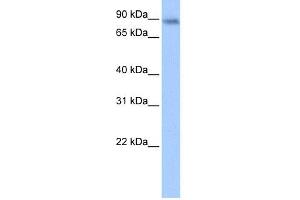 WB Suggested Anti-JAKMIP1 Antibody Titration:  0. (JAKMIP1 anticorps  (Middle Region))