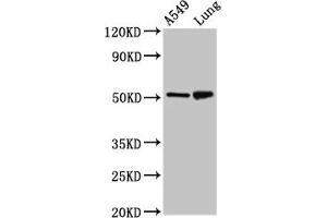 Western Blot Positive WB detected in: A549 whole cell lysate, Rat lung tissue All lanes: IRX3 antibody at 5 μg/mL Secondary Goat polyclonal to rabbit IgG at 1/50000 dilution Predicted band size: 53 kDa Observed band size: 53 kDa (IRX3 anticorps  (AA 285-378))