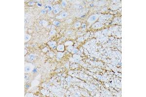 Immunohistochemistry of paraffin-embedded mouse spinal cord using E/SLC1 Rabbit mAb (ABIN7270394) at dilution of 1:100 (40x lens). (SLC1A3 anticorps)