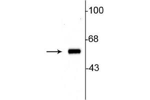 Western blot of 10ug of rat striatal lysate showing specific immunolabeling of the ~60 kDa tyrosine hydroxylase protein. (Tyrosine Hydroxylase anticorps)