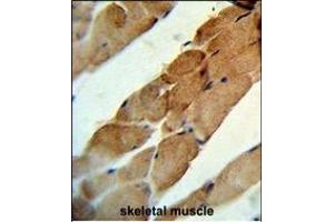 Formalin-fixed and paraffin-embedded human skeletal muscle reacted with TNFSF11 Antibody (N-term), which was peroxidase-conjugated to the secondary antibody, followed by DAB staining. (RANKL anticorps  (N-Term))