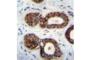 Fixed and paraffin embedded human breast tissue stained QTRTD1 Antibody (C-term) Cat.