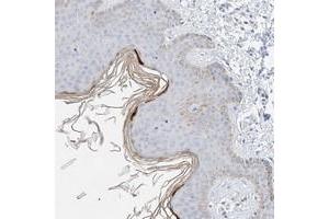 Immunohistochemical staining of human skin with KPRP polyclonal antibody  shows positivity in upper layer of epidermis at 1:200-1:500 dilution. (KPRP anticorps)