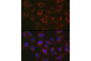 Immunofluorescence analysis of A-549 cells using GPLD1 Rabbit pAb (ABIN6131716, ABIN6141335, ABIN6141336 and ABIN6222300) at dilution of 1:50 (40x lens). (GPLD1 anticorps  (AA 24-160))