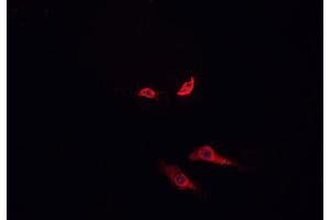 ABIN6266929 staining MCF-7 cells by IF/ICC.