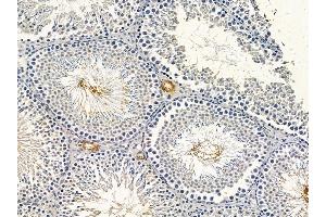 ABIN6264694 and ABIN6278626 at 1/100 staining rat testis tissue by IHC-P. (RELT anticorps  (C-Term))