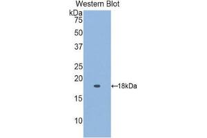 Western Blotting (WB) image for anti-Retinol Binding Protein 5, Cellular (RBP5) (AA 2-135) antibody (ABIN1860417) (Retinol Binding Protein 5 anticorps  (AA 2-135))
