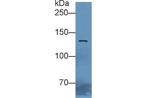 Detection of 0 in Rat Liver lysate using Polyclonal Antibody to E-cadherin