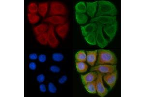 ABIN6263246 and ABIN6274024 staining Hela cells(45 min of heat-shock) by IF/ICC. (MICA anticorps  (C-Term))