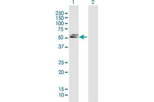 Western Blot analysis of DBT expression in transfected 293T cell line by DBT MaxPab polyclonal antibody.