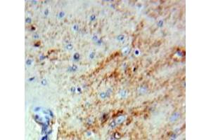 Used in DAB staining on fromalin fixed paraffin-embedded Brain tissue (SERPINB2 anticorps  (AA 170-393))