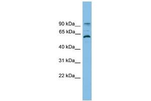 WB Suggested Anti-ANKRD5 Antibody Titration: 0. (ANKRD5 anticorps  (N-Term))