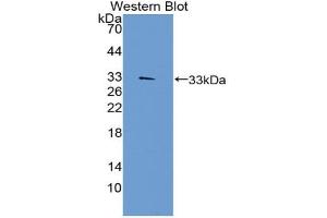 Western blot analysis of the recombinant protein. (TEP1 anticorps  (AA 2368-2627))