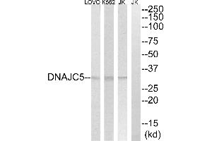 Western blot analysis of extracts from Jurkat, K562 and LOVOO cells, using DNAJC5 antibody.