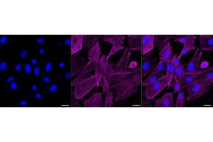 Immunocytochemical staining of H9c2 cells with PDLIM1 antibody (ABIN7799748), 1:1,000). (Recombinant PDLIM1 anticorps)