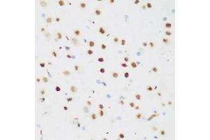 Immunohistochemistry of paraffin-embedded mouse brain using CSRNP1 antibody (ABIN5974288) at dilution of 1/200 (40x lens). (AXUD1 anticorps)