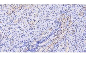 Detection of ALB in Human Kidney Tissue using Polyclonal Antibody to Albumin (ALB)