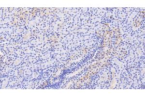 Detection of ALB in Human Kidney Tissue using Polyclonal Antibody to Albumin (ALB) (Albumin anticorps)