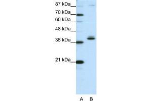 WB Suggested Anti-ZNF25 Antibody Titration:  1. (ZNF25 anticorps  (C-Term))