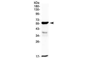 Western blot testing of rat small intestine lysate with GALNS antibody at 0. (GALNS anticorps)