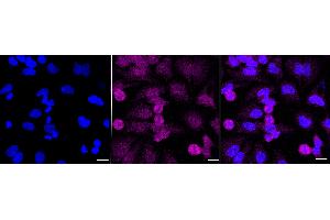 anti-Fragile Histidine Triad (FHIT) antibody